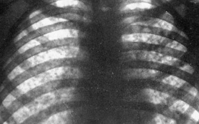 Najatí cizinci mohou šířit nemoci, varují odbory. Požadují více kontrol