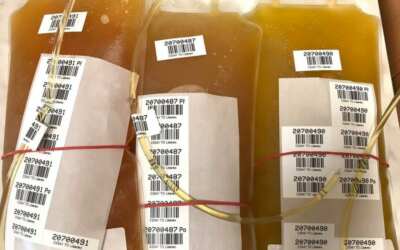 freedlantsko.eu 39 Prodělali jste v létě covid-19? Vaše krevní plazma může pomoct dalším pacientům s touto nemocí